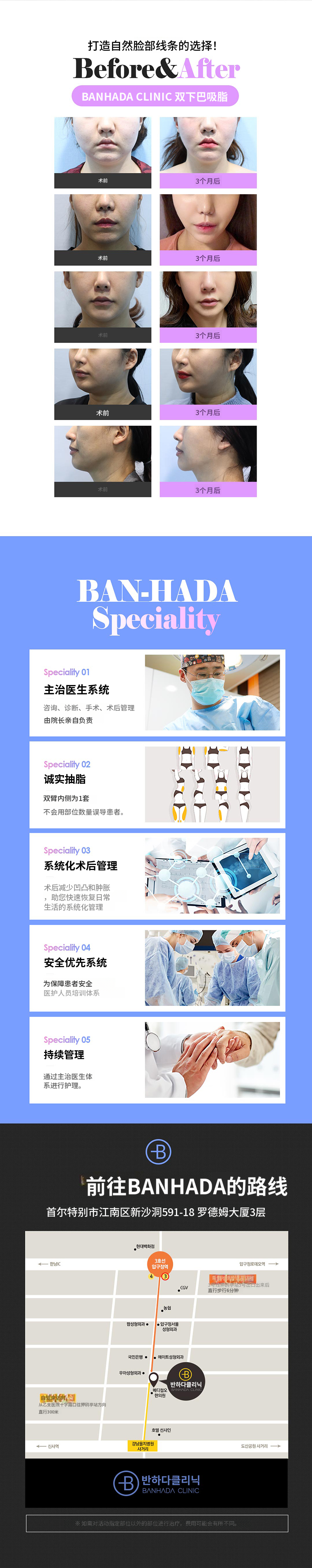 修长脸型 双下巴脂肪吸引