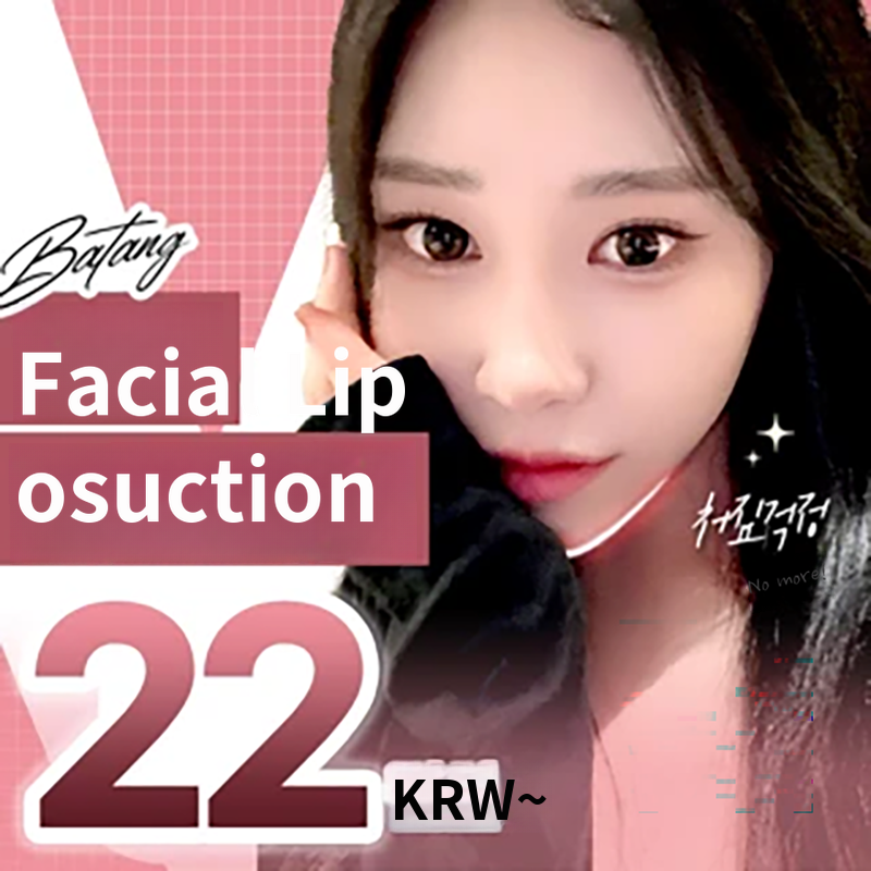 V-Line Facial Liposuction with Cheek and Double Chin