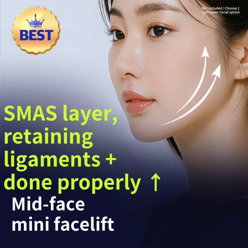 Proper Mini Facelift SMAS Layer Separation & Retention Ligament