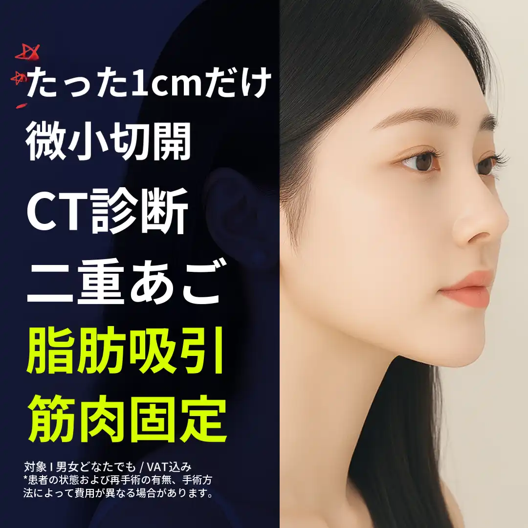 二重あご脂肪吸引、筋肉結束_1cm切開、CT診断