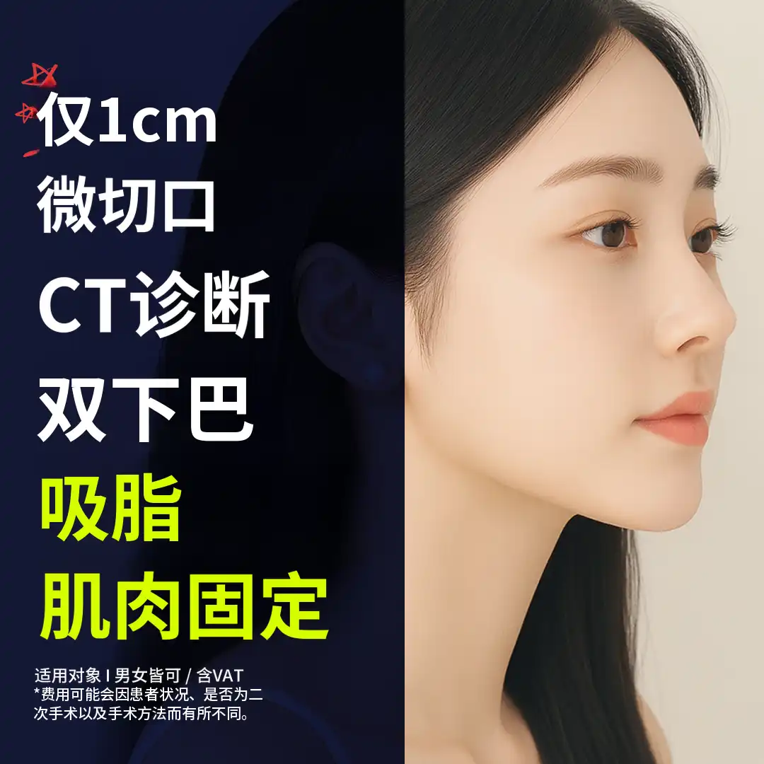 双下巴脂肪抽吸，肌肉束缚_1厘米切口，CT诊断