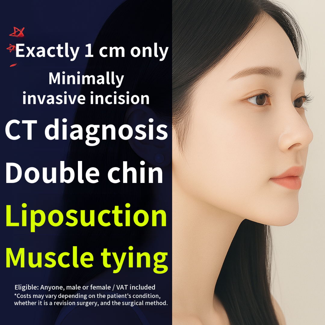 Double Chin Liposuction, Muscle Tightening_1cm Incision, CT Diagnosis