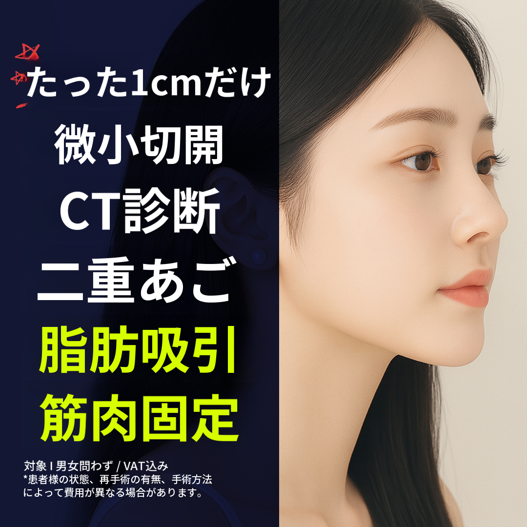 二重あご脂肪吸引、筋肉固定1cm切開、CT診断