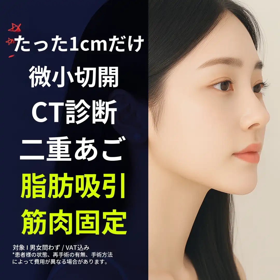 ダブルチン脂肪吸引、筋肉結束_1cm切開、CT診断