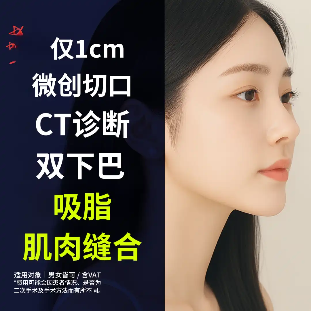 双下巴脂肪抽吸，肌肉束缚_1厘米切口，CT诊断