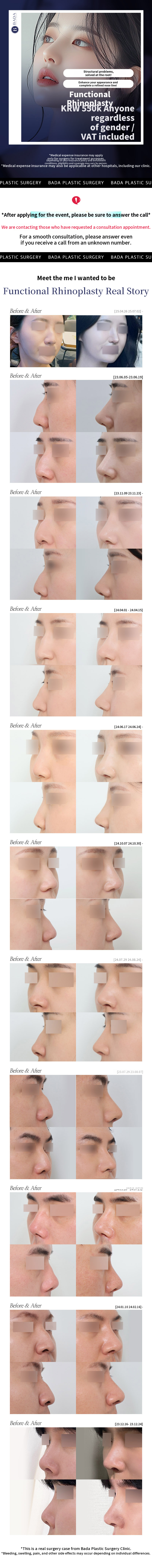 Sea Functional Nose Surgery