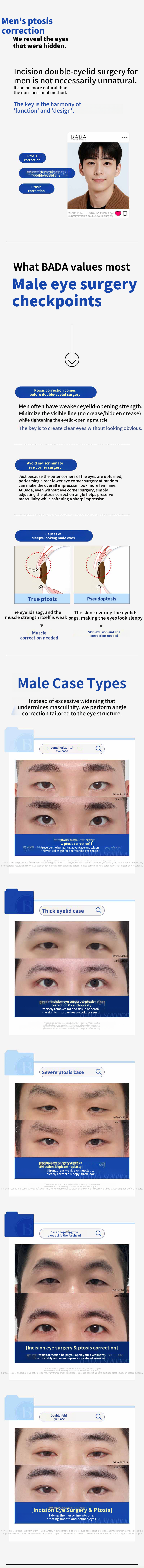 First Snow Cosmetic Surgery Double Eyelid Surgery_Embedding, Incision, Eyelid Correction, Slit
