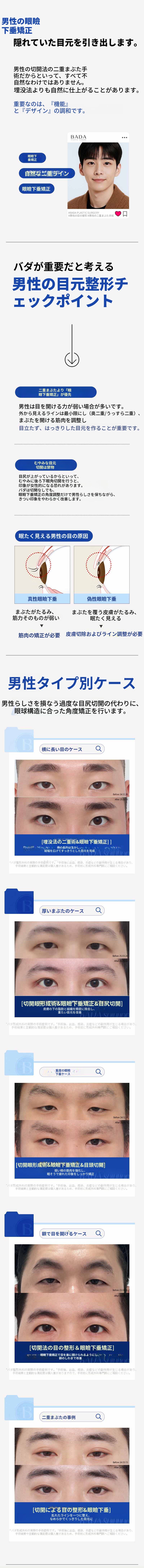 初雪整形 二重まぶた_埋没、切開、目の形修正、切開