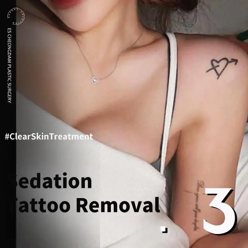 Pain-Free Tattoo Removal