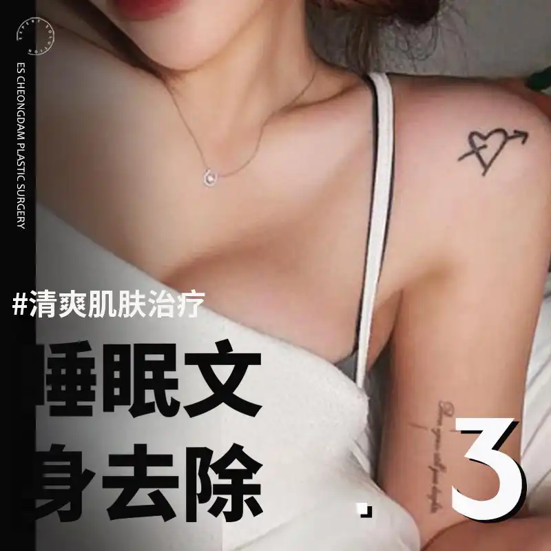 无痛睡眠纹身去除