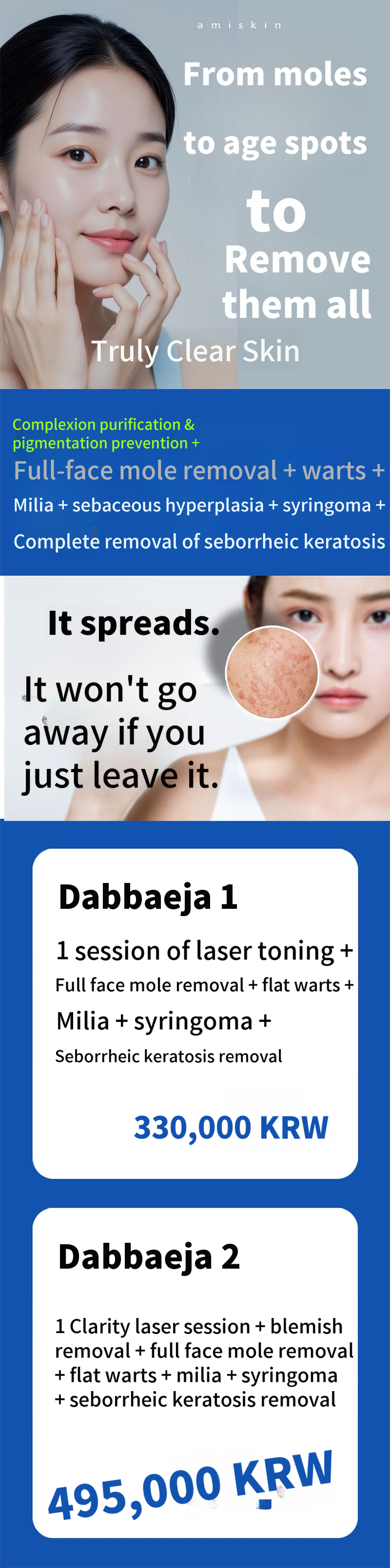 Let's Remove Pigmentation, Moles, and Warts
