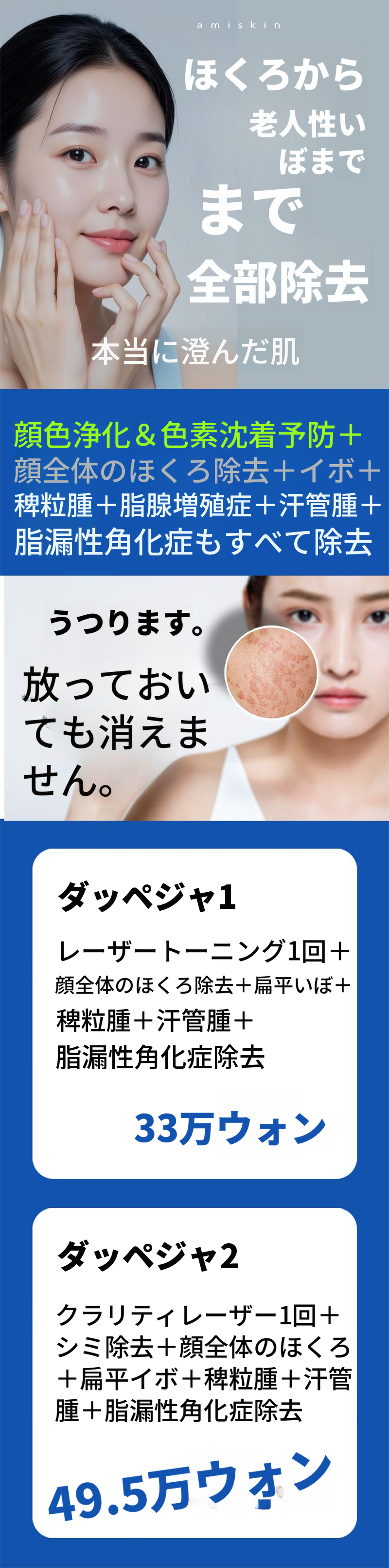 色素、ホクロ、イボを全て除去