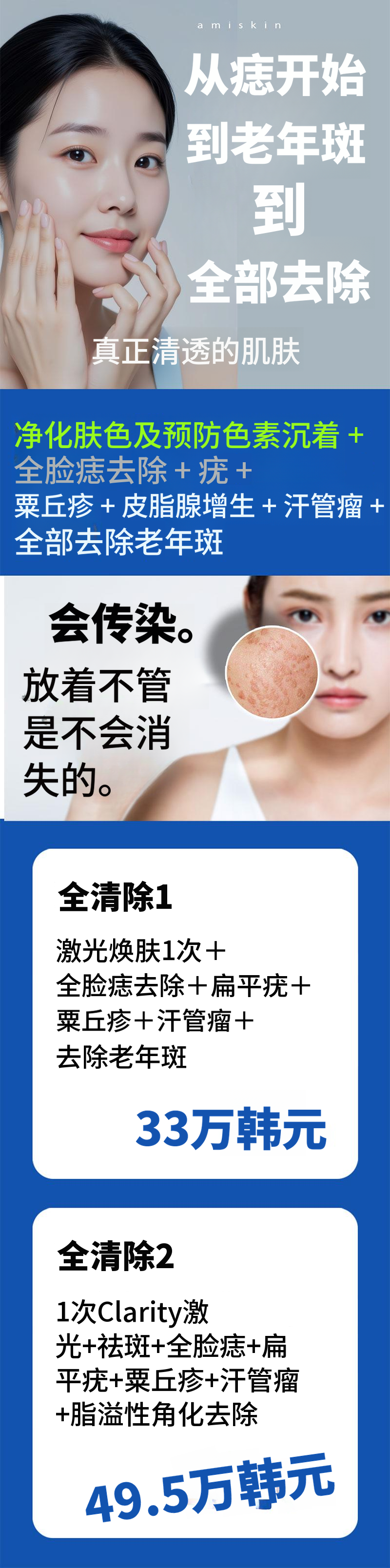 去除色素、痣、疣