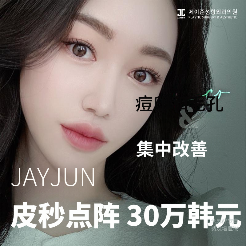 痤疮疤痕微针激光