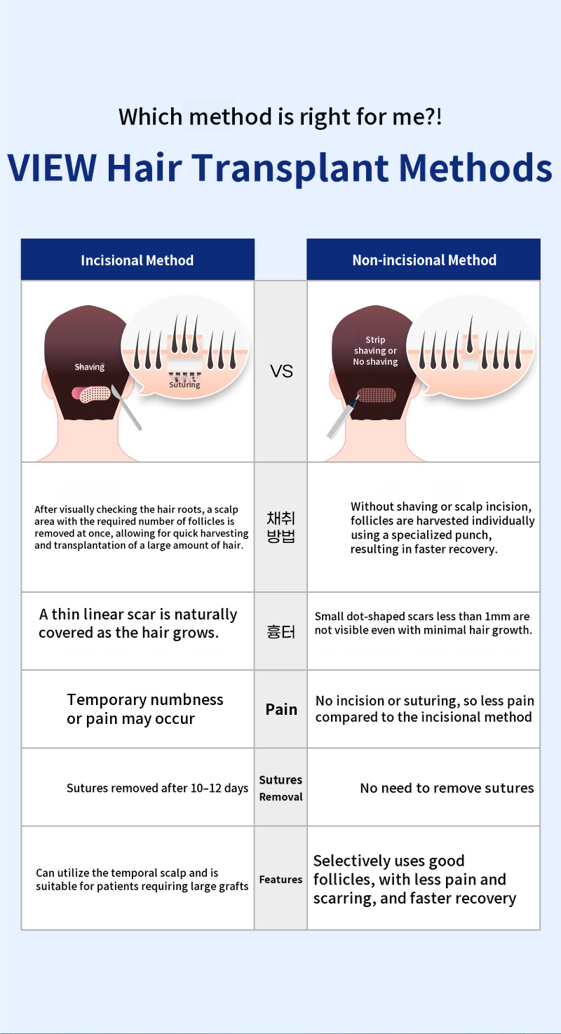 ❤View❤Hair Transplant