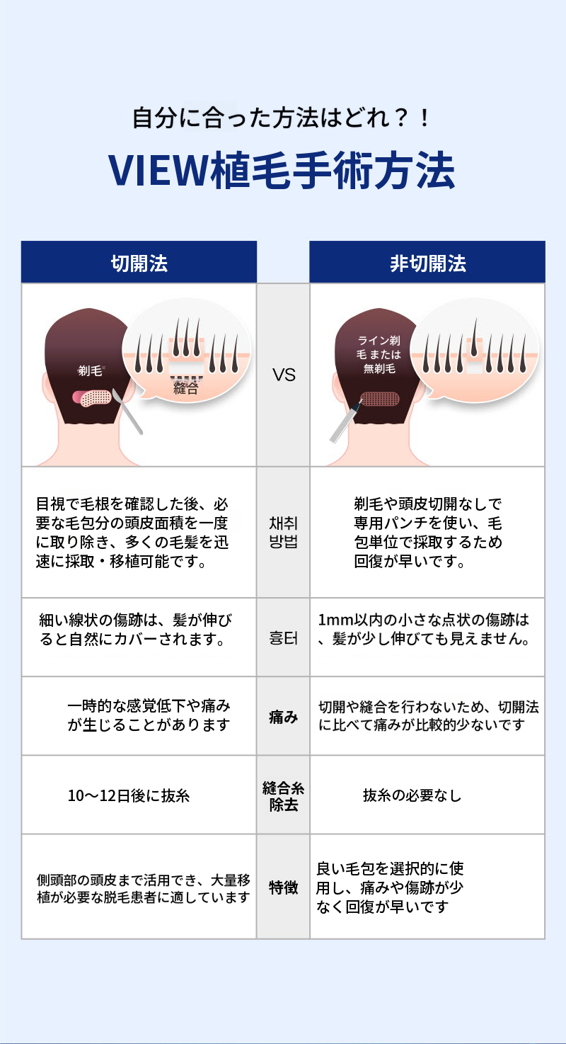 ❤ビュ❤毛髪移植