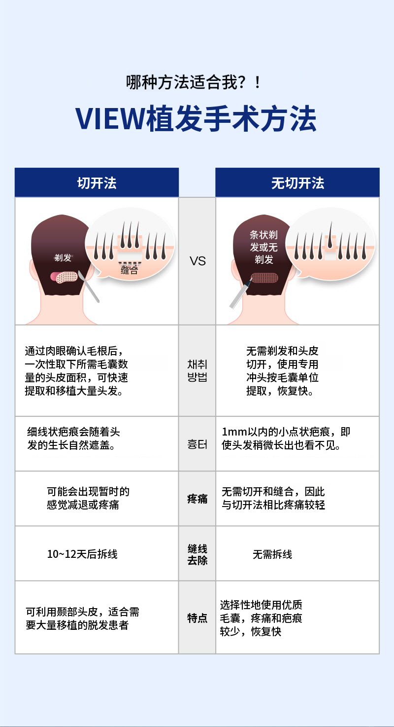 ❤美丽❤毛发移植