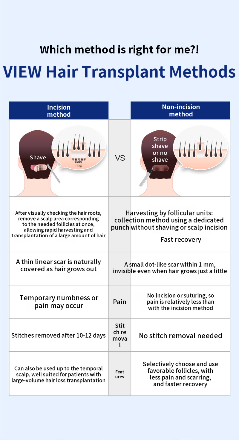 ❤View❤Hair Transplant