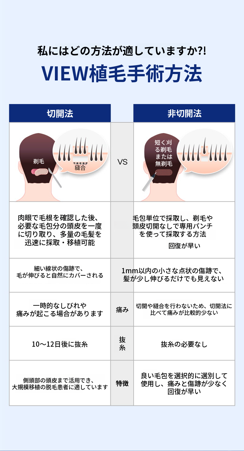❤ビュ❤毛髪移植