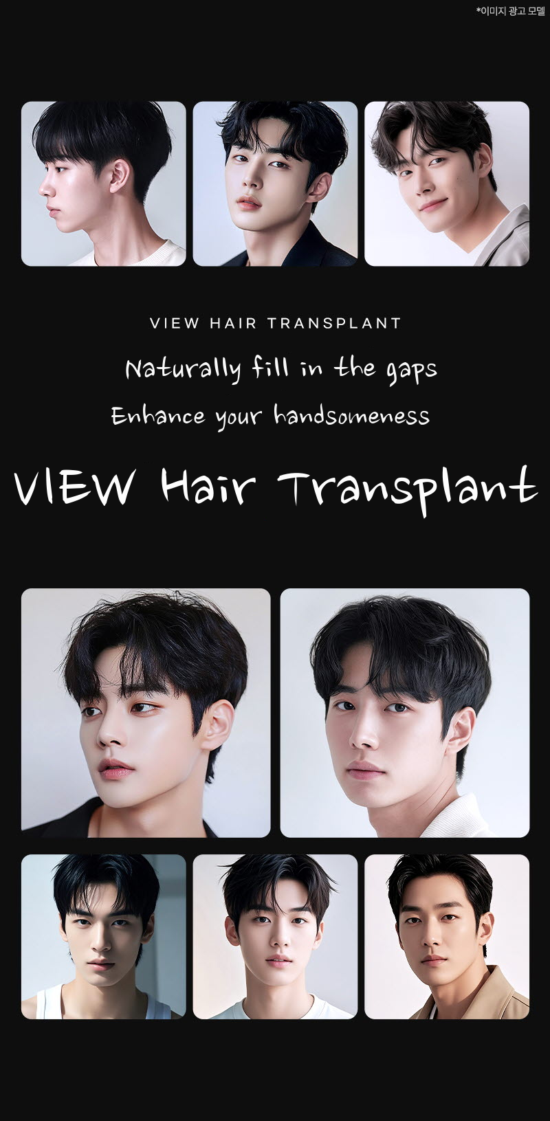 ❤View❤Hair Transplant