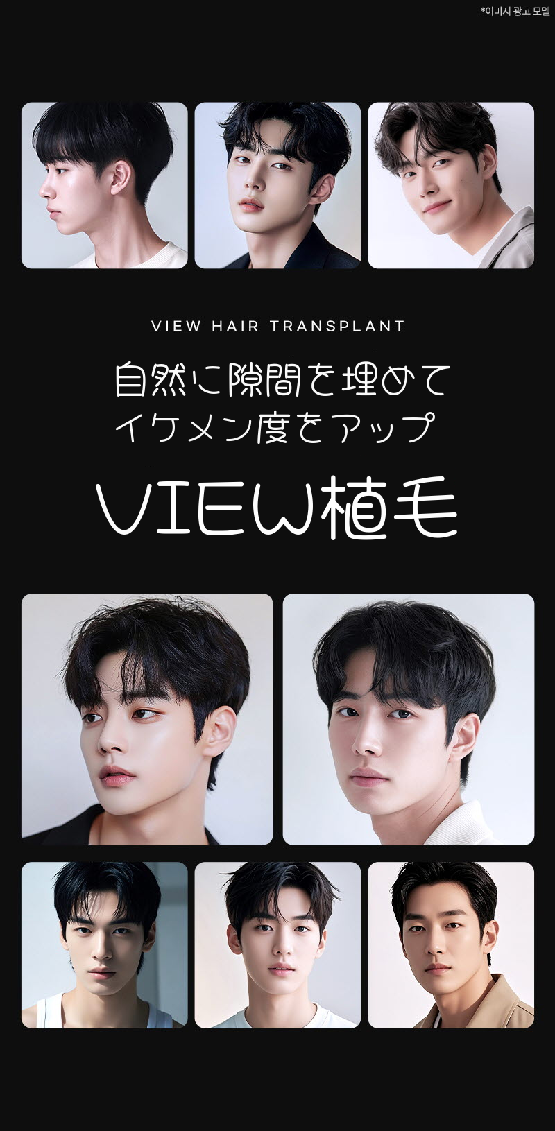 ❤ビュ❤毛髪移植