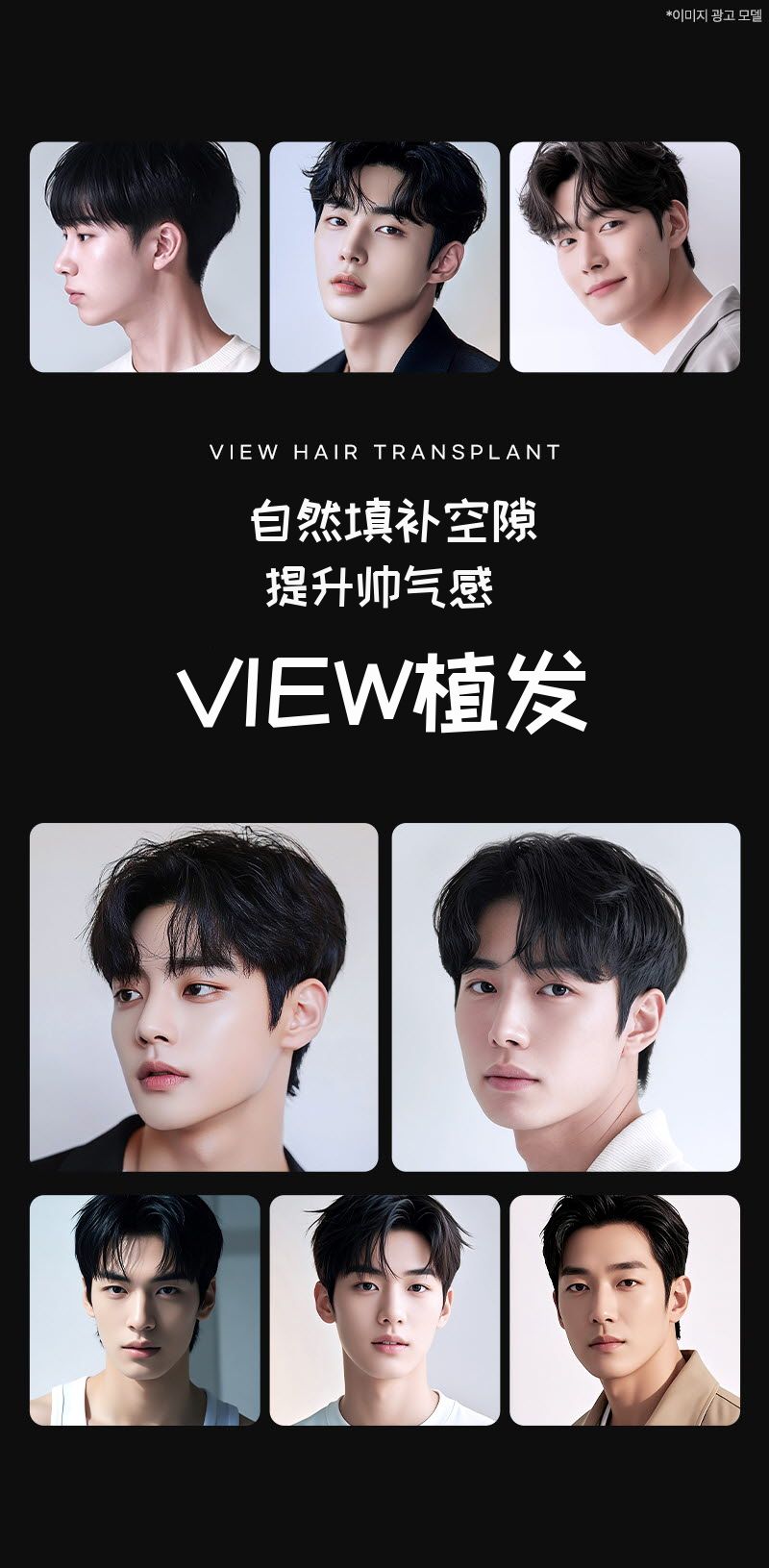 ❤美丽❤毛发移植