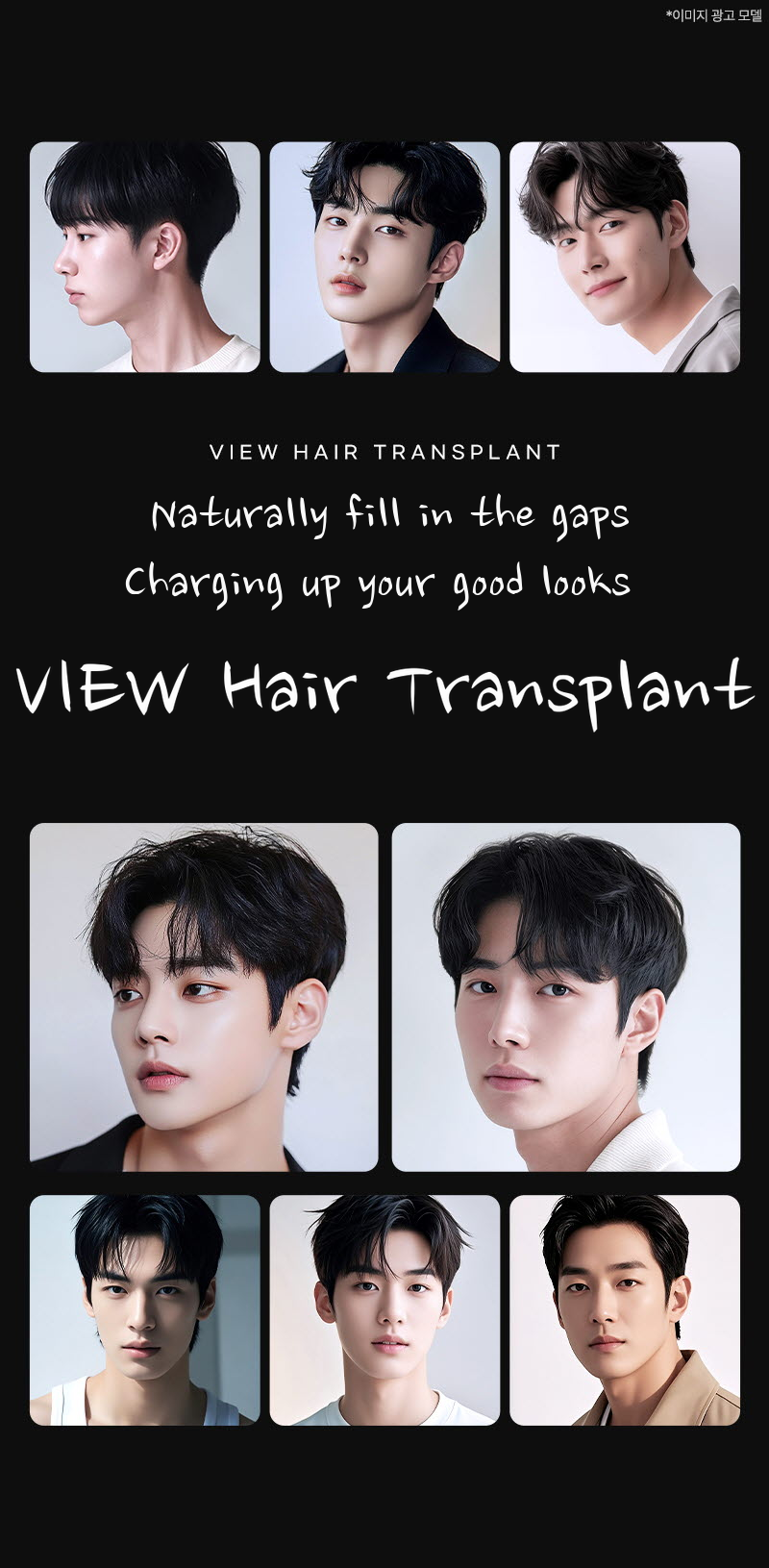 ❤View❤Hair Transplant