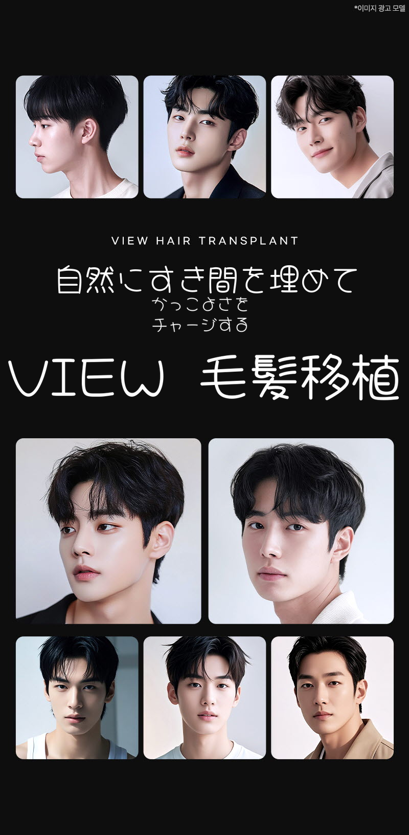 ❤ビュ❤毛髪移植