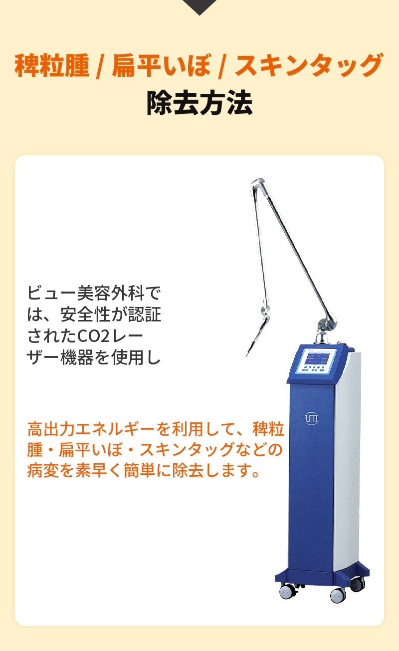 ❤ビュー❤肌のトラブル除去（ミリ粒腫、イボ、ほくろ）