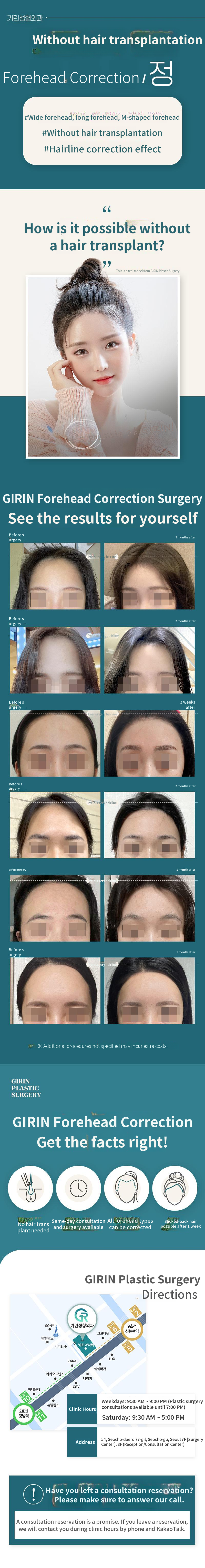 Forehead Correction Without Hair Transplant
