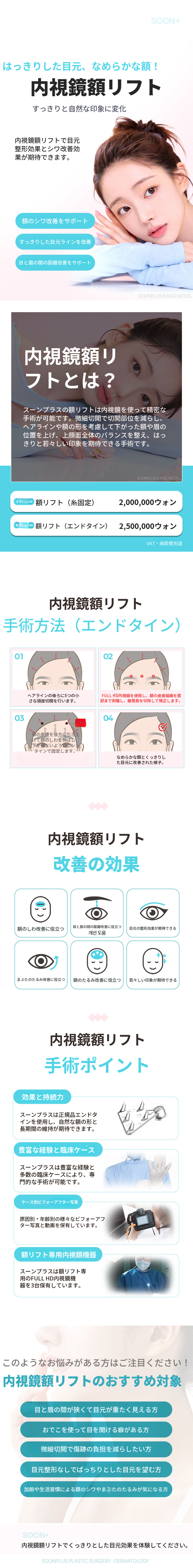 スンプラス・内視鏡額リフト