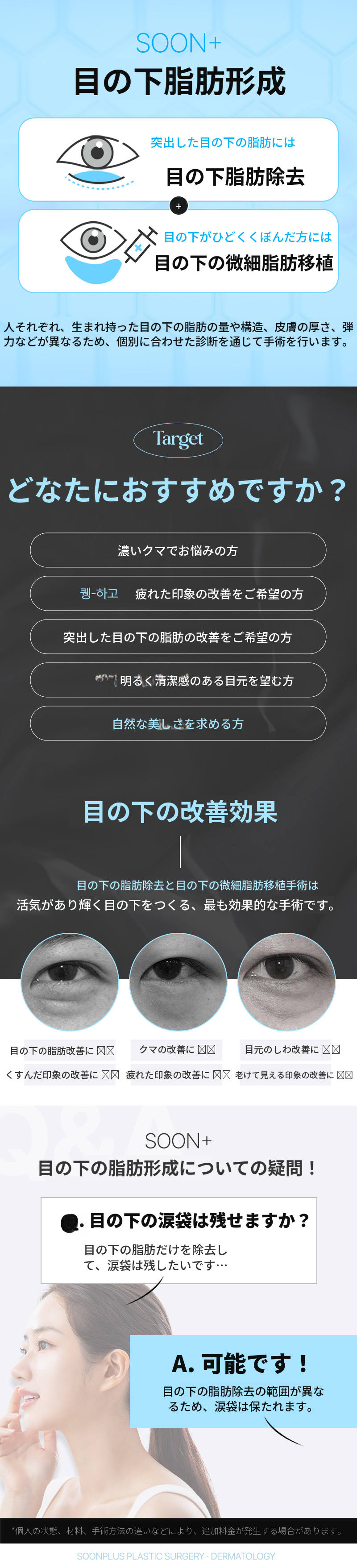 スンプラス_目の下の脂肪除去+目の下の脂肪移植