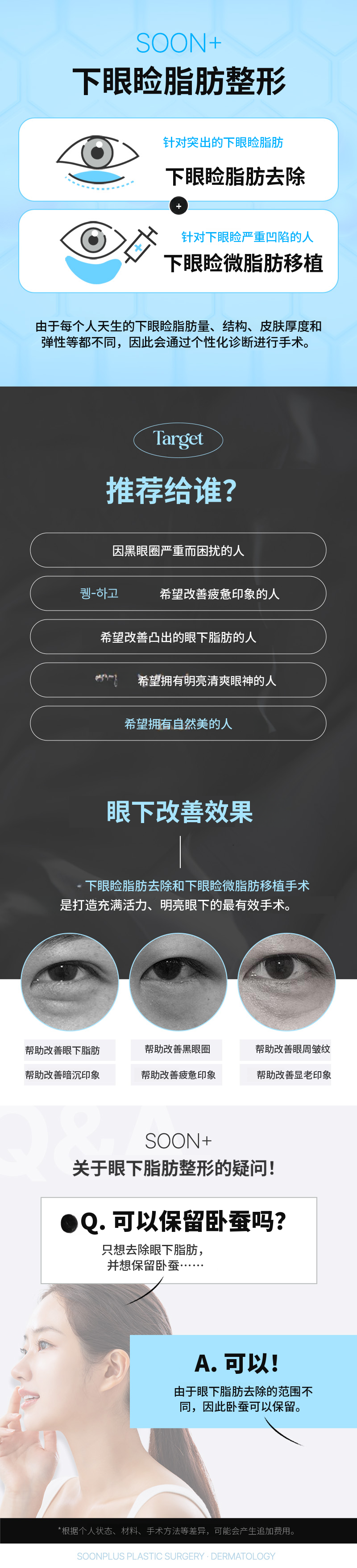 顺加_下眼睑脂肪去除+下眼睑脂肪移植