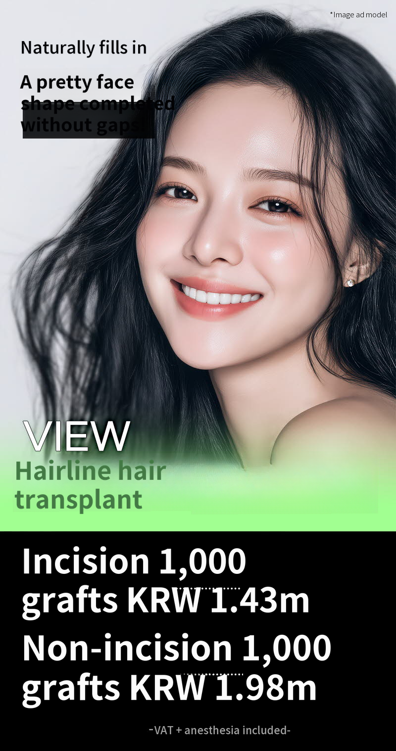 ❤View❤ Hairline Hair Transplant