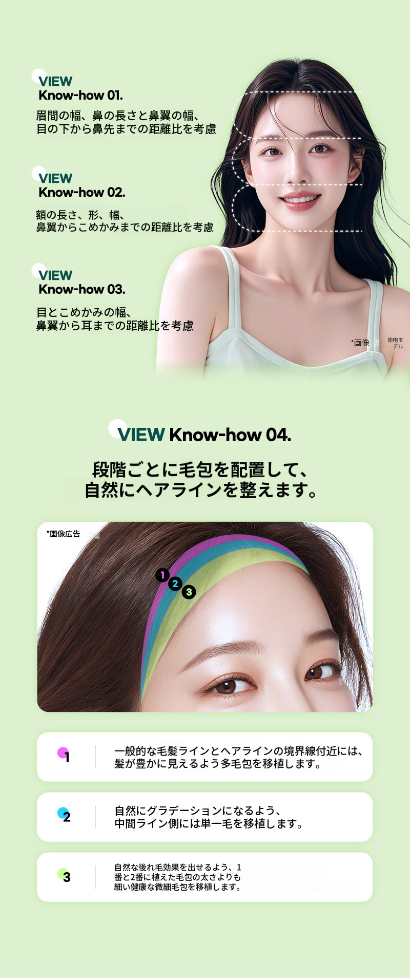 ❤ビュー❤ヘアラインの毛髪移植