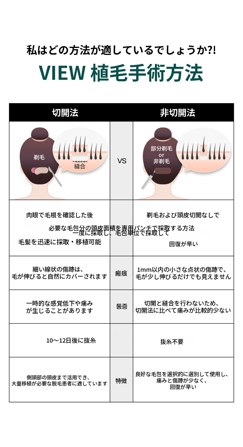 ❤ビュー❤ヘアラインの毛髪移植