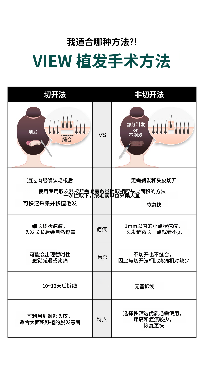 ❤视角❤发际线头发移植