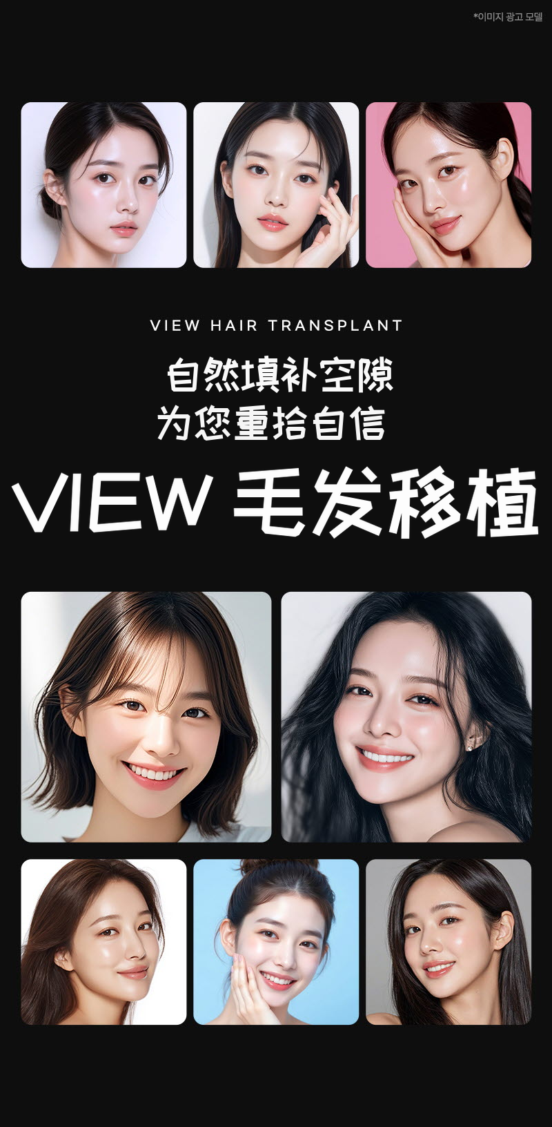 ❤视角❤发际线头发移植