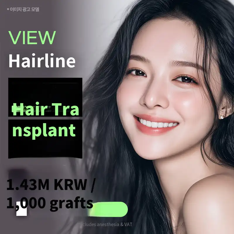 ❤View❤ Hairline Hair Transplant