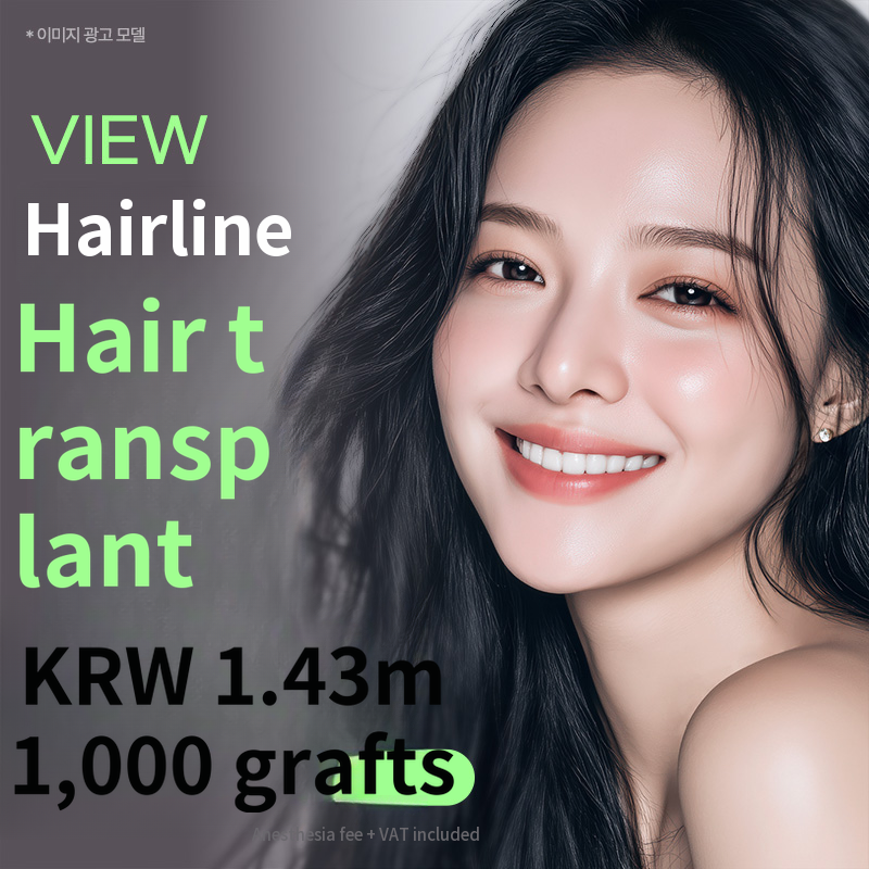 ❤View❤ Hairline Hair Transplant