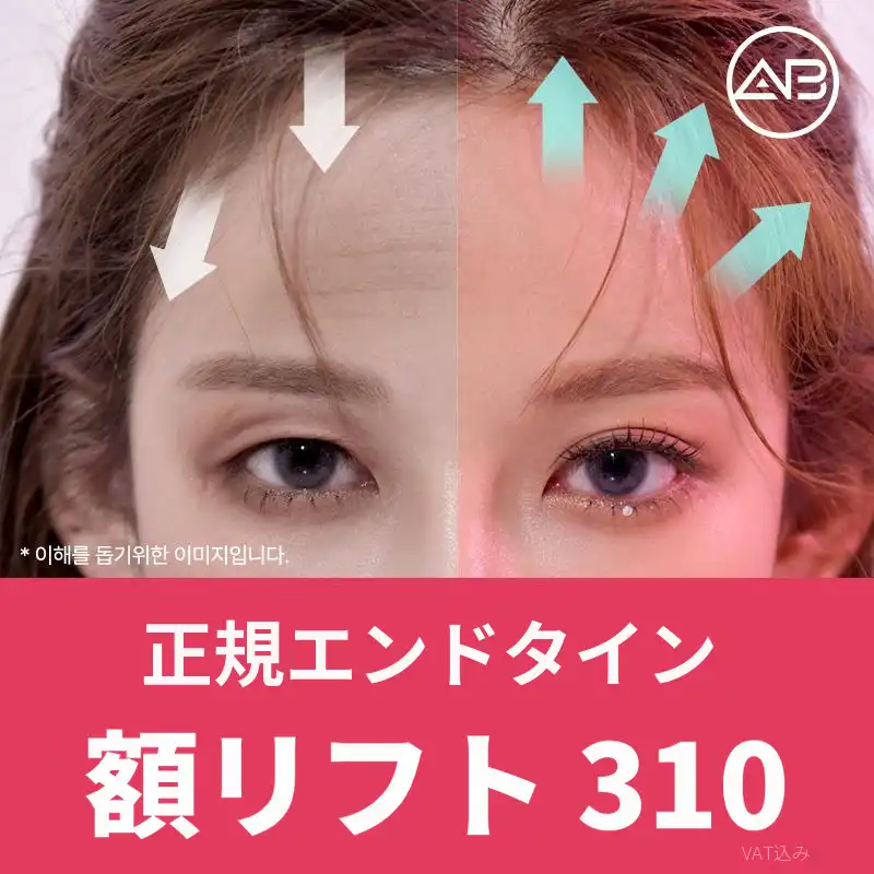 エイビー 内視鏡おでこリフト