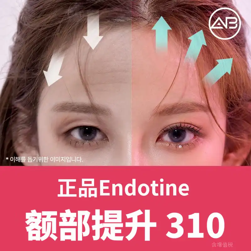 AB内窥镜额头提升