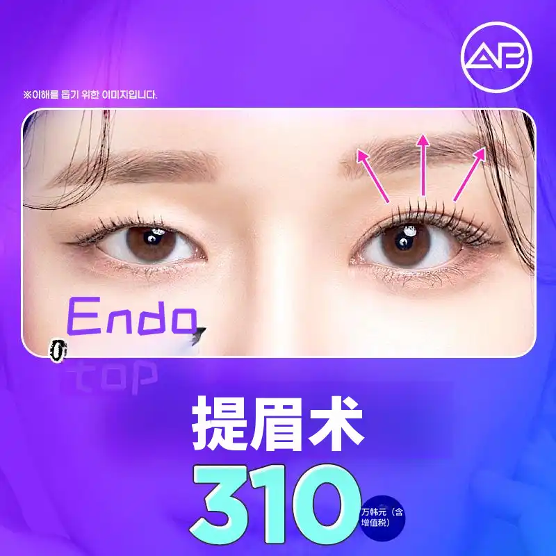 AB眉毛提升术