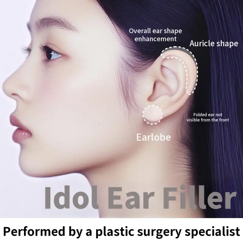 Tilted Ear Lobe Filler Ear Filler