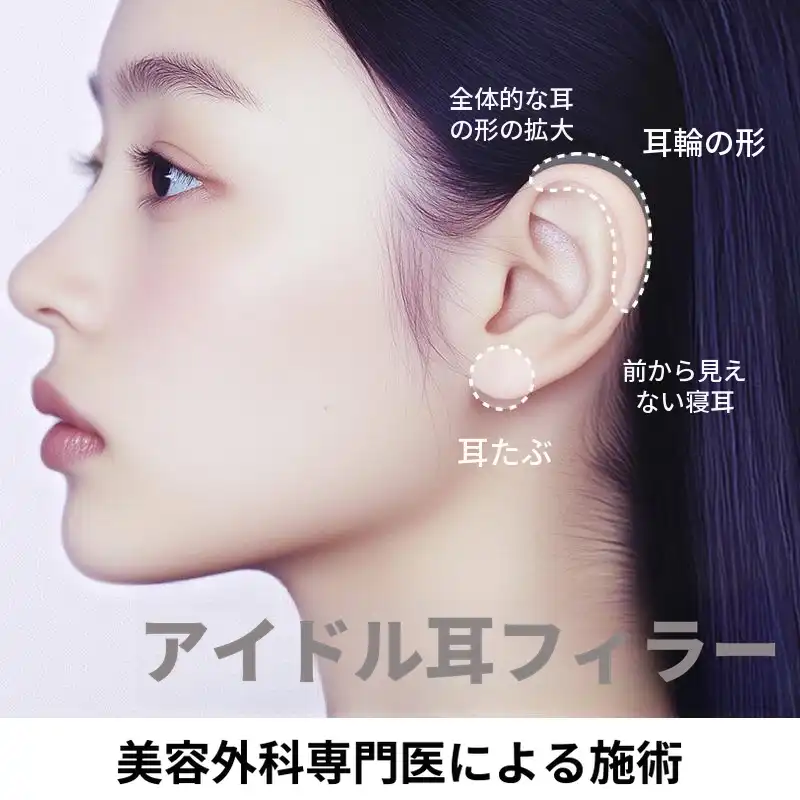 横耳 耳たぶフィラー 耳フィラー