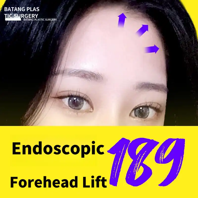 Endoscopic Forehead Lifting Surgery Base