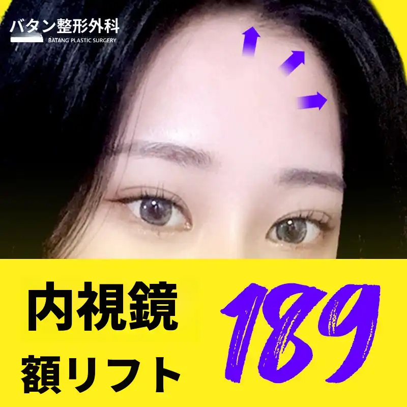 内視鏡 おでこリフト術 基盤