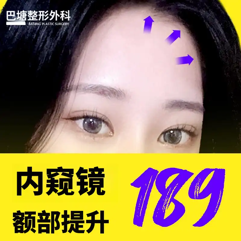 内窥镜额头提升术基础