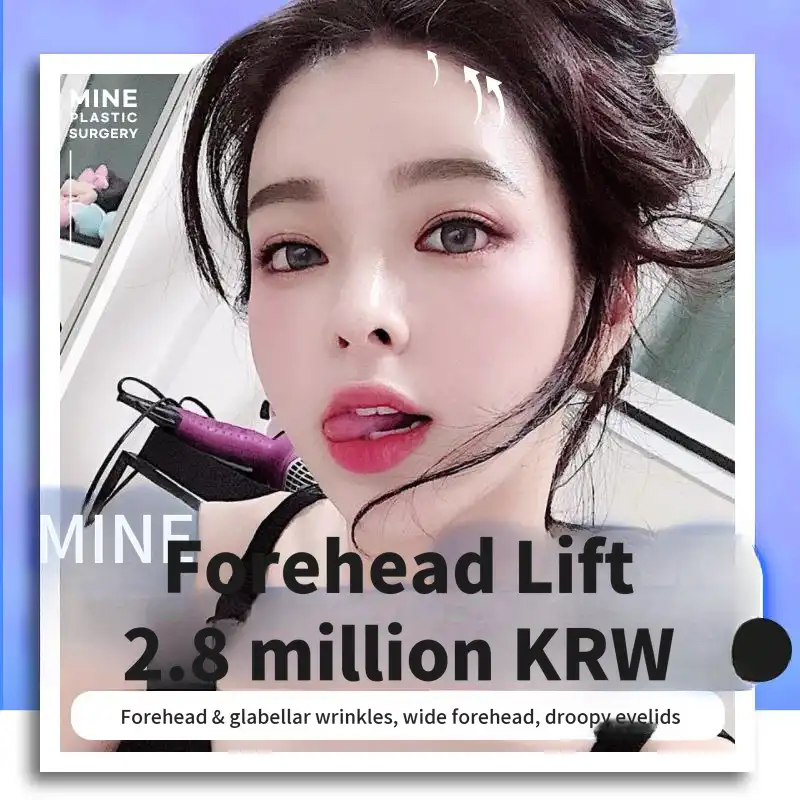 Mine Endoscopic Forehead Lift