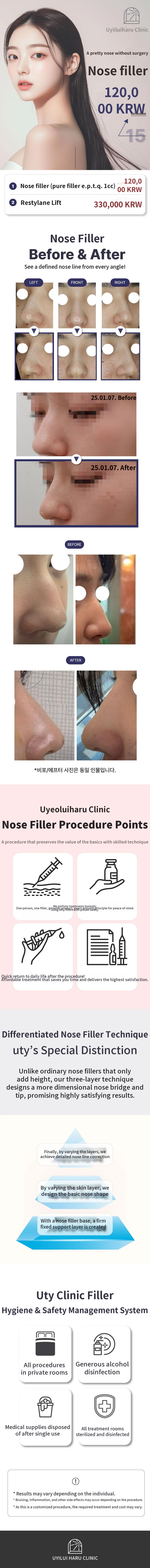 One Day in June Custom Nose Filler